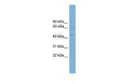 FOXD4 Rabbit anti-Human, Polyclonal, Novus Biologicals 0.1ml; Unconjugated:Antibodies,